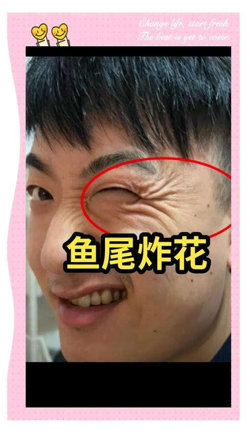 鱼尾纹形状各异，交叉分布的鱼尾纹对男人面相有何影响？(图2)